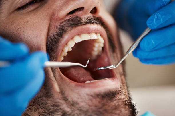 Best Knocked-Out Tooth Emergency  in Normal, IL